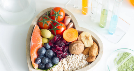 Ateliers nutrition 